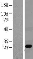 PGRPS (PGLYRP1) Human Over-expression Lysate