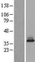 NACA Human Over-expression Lysate