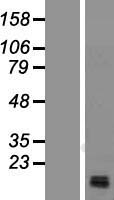 Map17 (PDZK1IP1) Human Over-expression Lysate