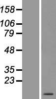 ATP5F1E Human Over-expression Lysate