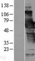 SCHIP1 Human Over-expression Lysate
