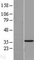 METTL9 Human Over-expression Lysate