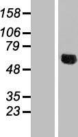 NDUFV3 Human Over-expression Lysate