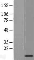 MANBAL Human Over-expression Lysate