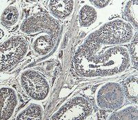 HOXA10 Antibody