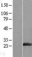 JPT2 Human Over-expression Lysate