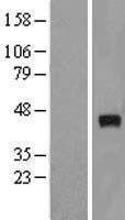 UBE2CBP (UBE3D) Human Over-expression Lysate