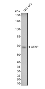 Human Glial Fibrillary Acidic Protein (GFAP) Antibody