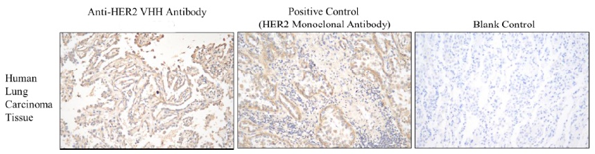 Human Epidermal Growth Factor Receptor 2 (Her2) Antibody