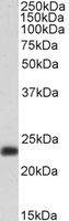 SM22 Alpha/Transgelin Antibody