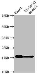 MB Monoclonal Antibody