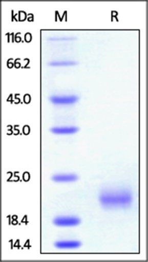 Rat GITR Protein, His Tag