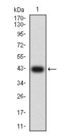 GRM2
