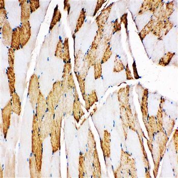 Myoglobin/MB Antibody