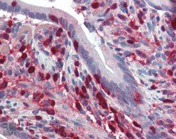 S100A4/CAPL Antibody
