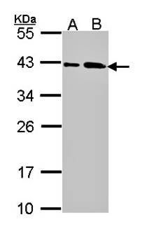 SAE1 antibody