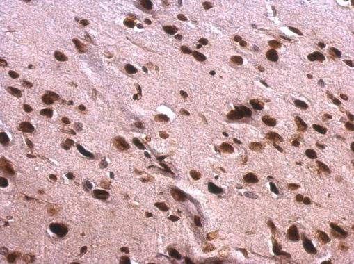 SAFB antibody