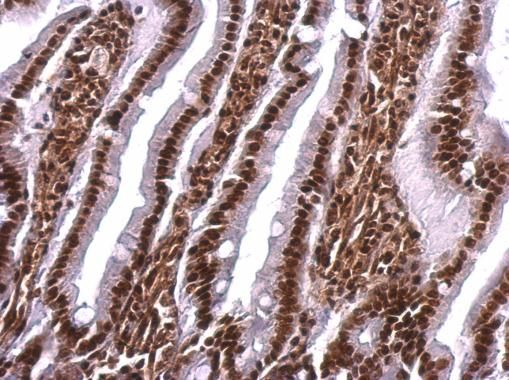 SAFB antibody