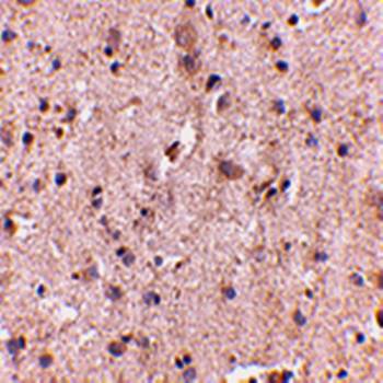 SAPAP2 Antibody