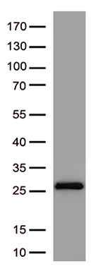SARS-CoV-2 S Protein Mouse Monoclonal Antibody [Clone ID: OTI4C6]