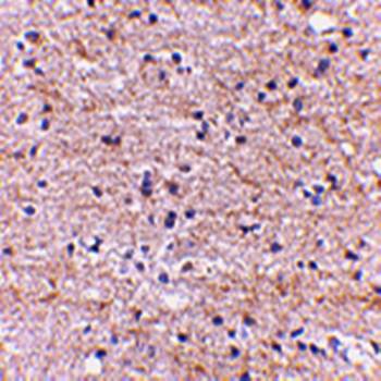 SATB2 Antibody