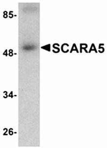 SCARA5 Antibody