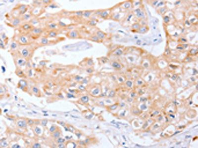SCARB1 Antibody