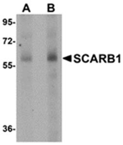 SCARB1 Antibody