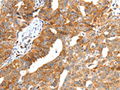 SCT Antibody