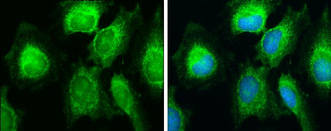 SDHB antibody [C2C3], C-term