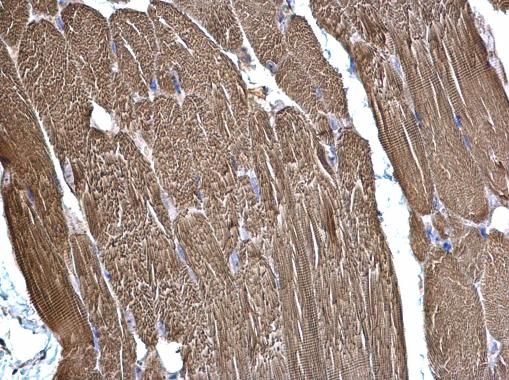SDHB antibody [C2C3], C-term