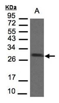 SDHB antibody