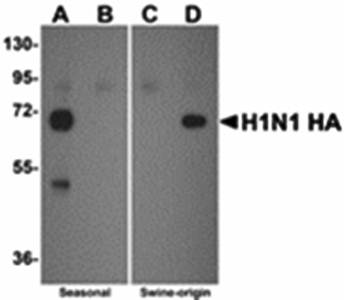 Seasonal H1N1 Hemagglutinin Antibody