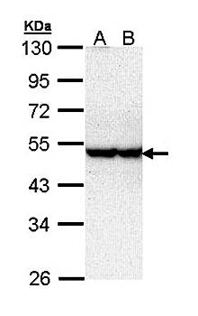 serine/threonine kinase 40 antibody