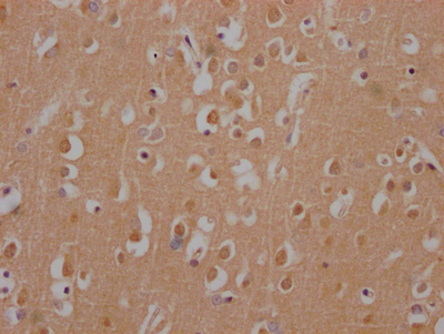 HTT Recombinant Monoclonal Antibody