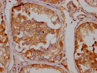 SLC6A4 Recombinant Monoclonal Antibody