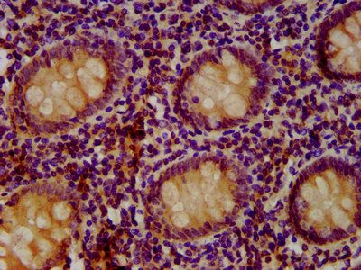 SETD3 Antibody