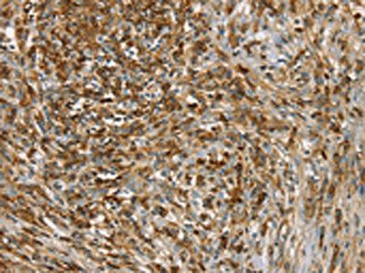 SIK1 Antibody