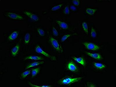 SLC1A6 Antibody