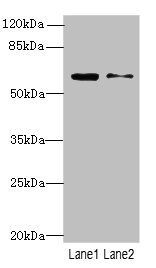 SLC1A6 Antibody