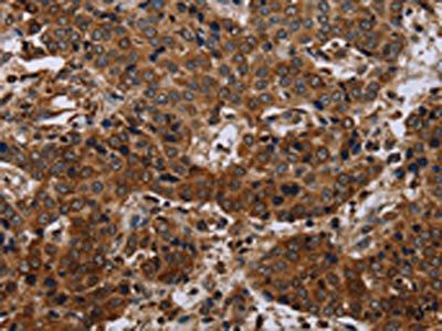 SLC1A6 Antibody