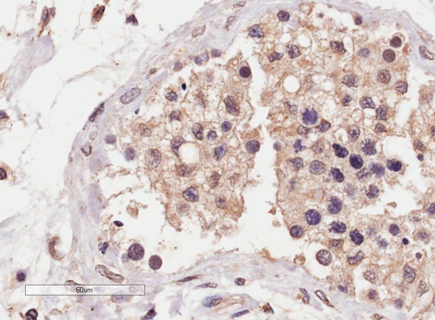 Goat anti-SLC22A16 Antibody