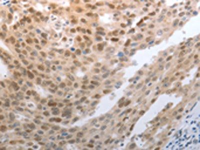 SLC22A8 Antibody