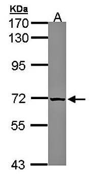 SLC25A13 antibody