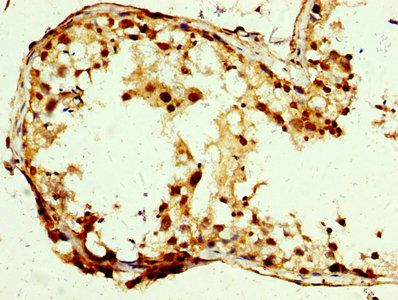 SLC25A24 Antibody