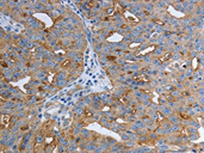 SLC34A2 Antibody