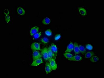 SLC35F2 Antibody