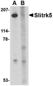 Slitrk5 Antibody