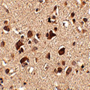 Slitrk6 Antibody