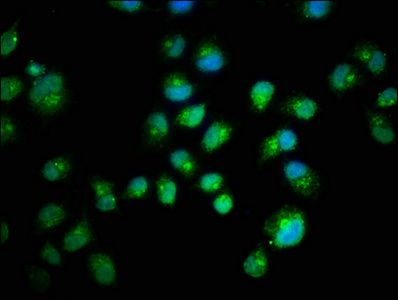 SMAD2 Antibody